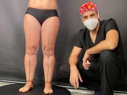 WhatsApp Image 2025-07-07 at 7.28.25 PM (4)